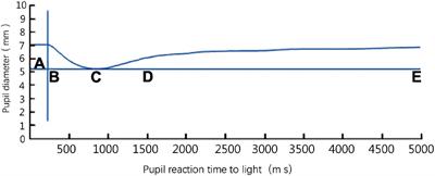 The Function of the Autonomic Nervous System in Asian Patients With Chronic Migraine